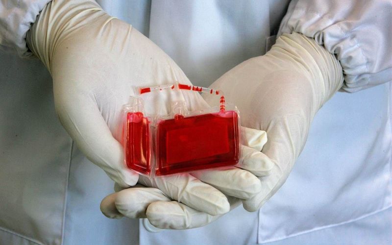 ۸۱۰ نمونه خون بندناف نوزادان در استان سمنان ذخیره شده است